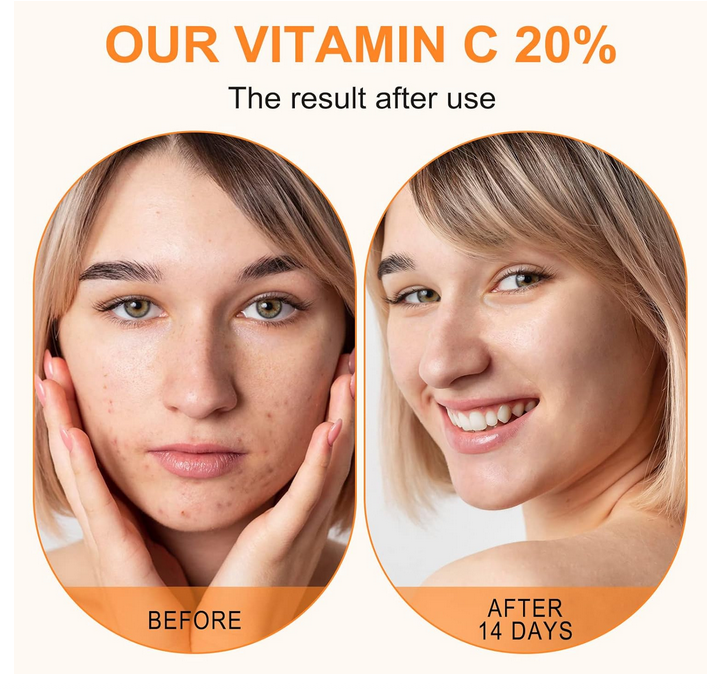 Serum Vitamina C Prémium Todo Tipo De Piel Día/noche