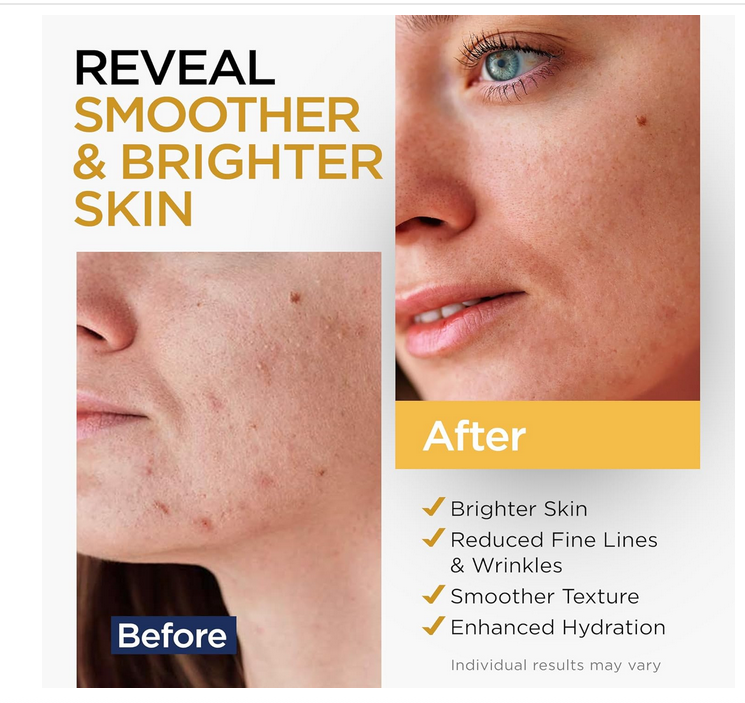 Suero Vitamina C Facial Iluminador Con Ácido Hialurónico Normal Día/noche